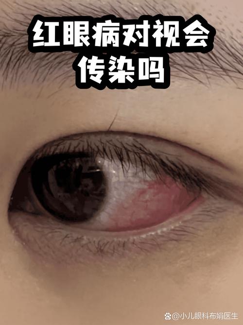 辽宁沈阳新增3例本土确诊病例，感染途径和病情情况公布